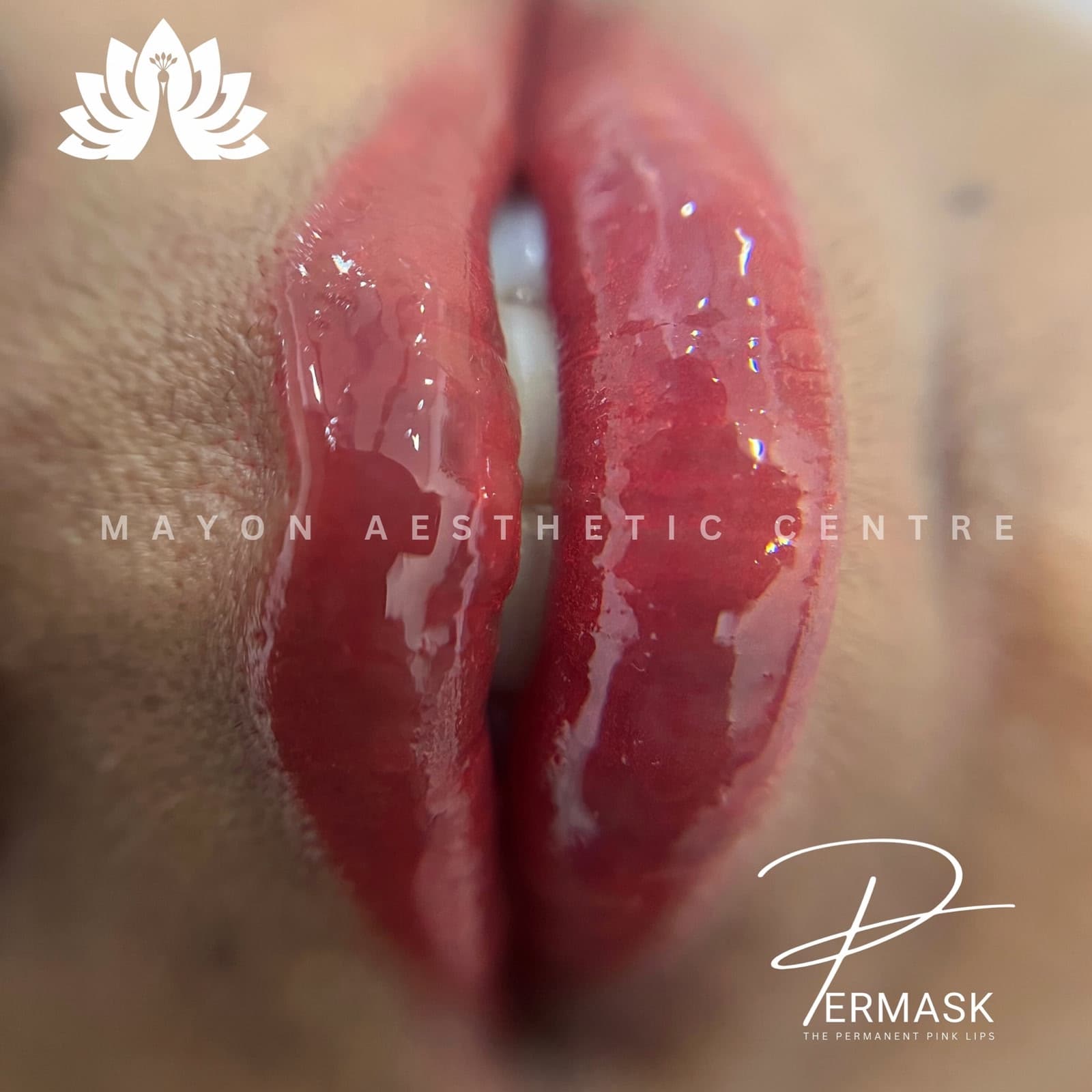 Lip blush permanent makeup at Mayon Aesthetic Centre
