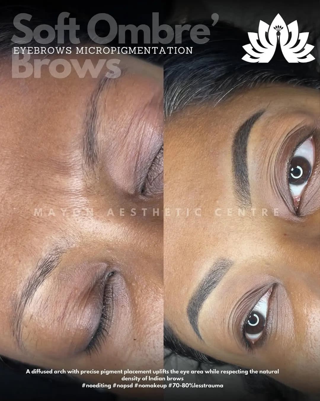 Ombré brow permanent makeup at Mayon Aesthetic Centre