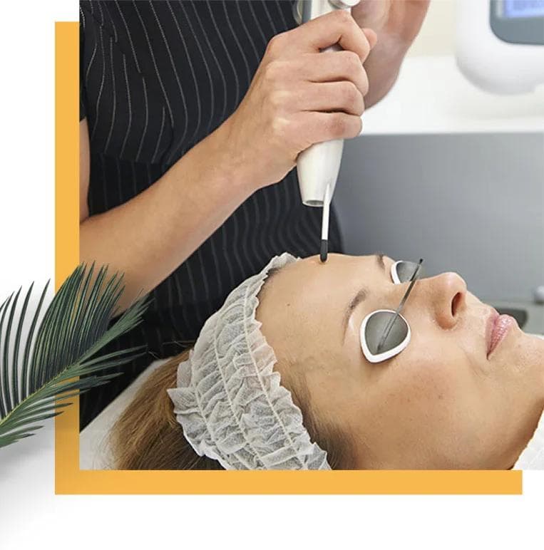 Q switch laser skin treatment at Mayon Aesthetic Centre