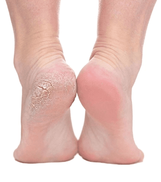 Heel & Foot Care