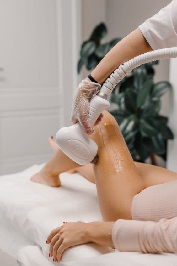Arms and legs laser hair removal at Mayon Aesthetic Centre